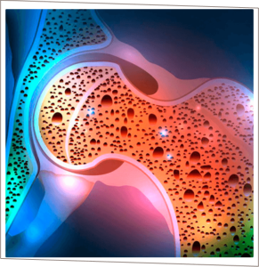 Tratamento e prevenção de Osteoporose;
